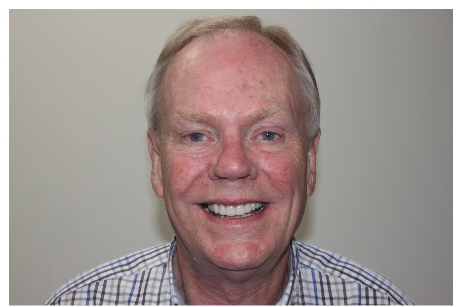 Patient smile after treatment