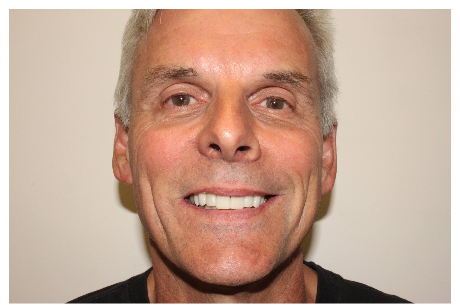 Patient smile after treatment