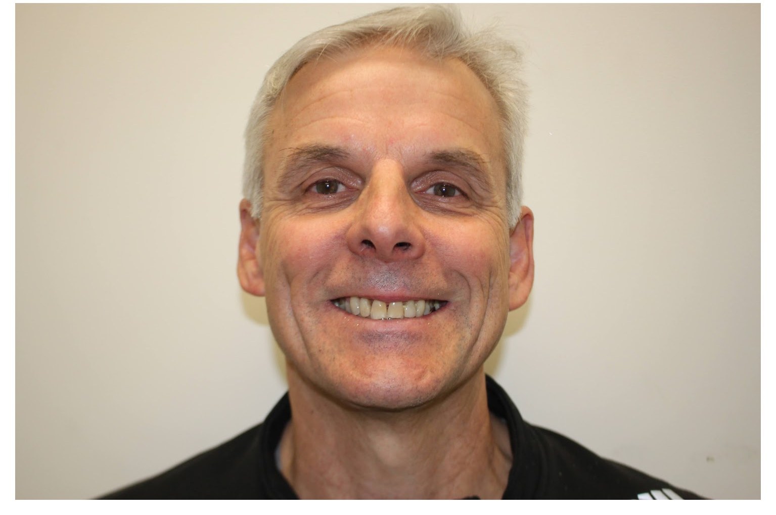 The same smile before treatment